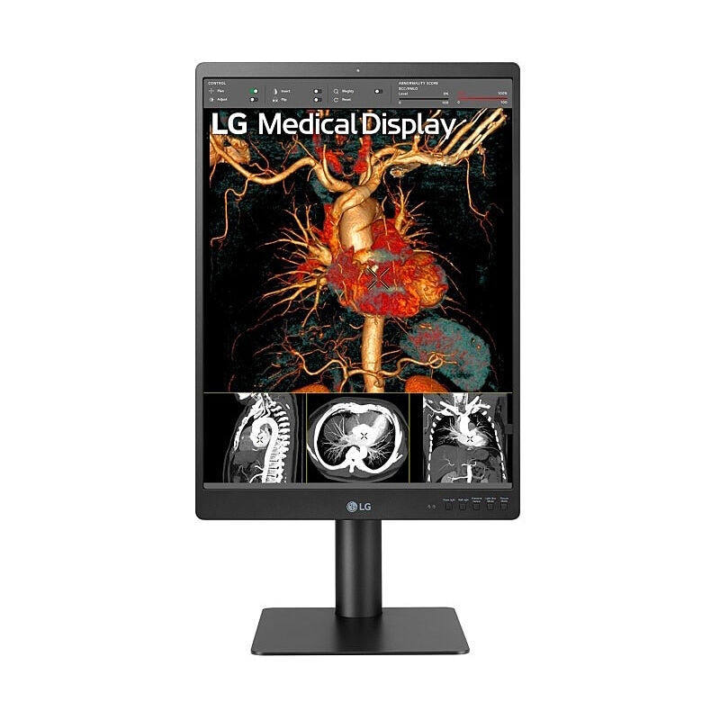 LG 21'' Medical Monitor [21HQ513D-S]